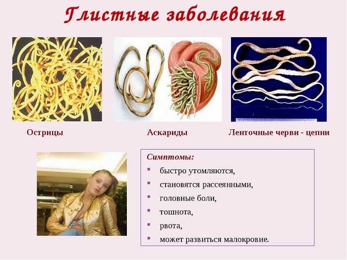 Глисты у детей: 15 признаков, 5 препаратов, 10 народных способов лечения