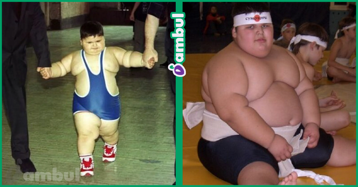 Как самому толстому в мире ребенку удалось сбросить 108 кг ❗️☘️ ( ͡ʘ ͜ʖ ͡ʘ)