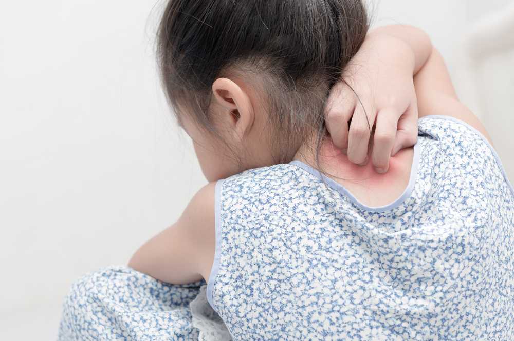 Что делать, если у ребенка появилась сыпь? — медицинский центр «целитель»