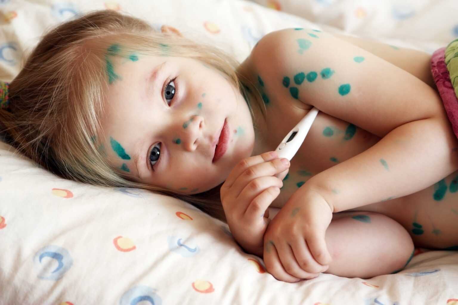 Болезнь пузырчатка: симптомы, фото, лечение у детей и взрослых