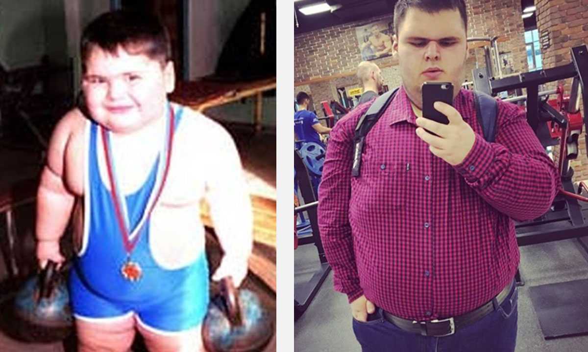 Родители кормили десятилетнего ребенка фастфудом до 192 кг, пока он не стал самым толстым мальчиком в мире