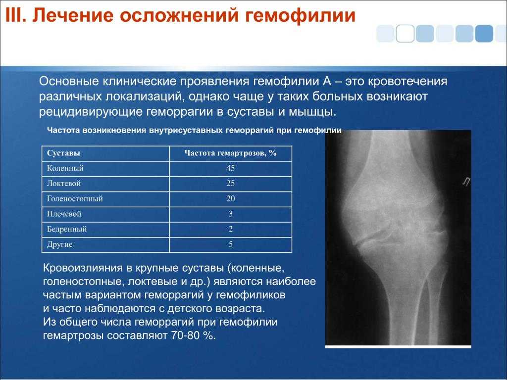 Артроз коленного сустава карта вызова