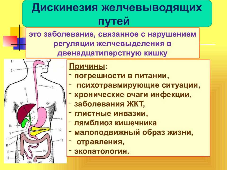 Заболевания желчевыводящих путей презентация