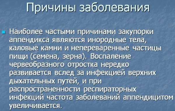 Аппендицит слева и другие чудеса: если болит живот, пройдите узи