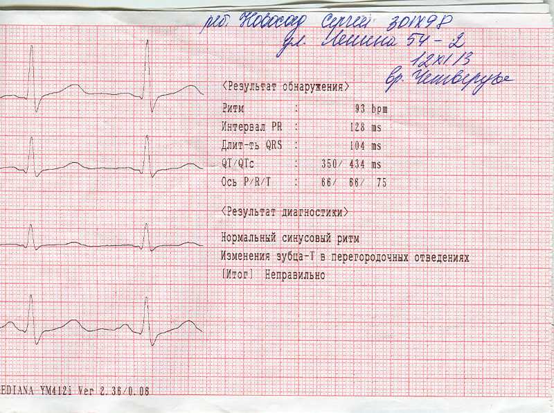 Когда ребенку необходимо плановое обследование у детского кардиолога | 1дмц