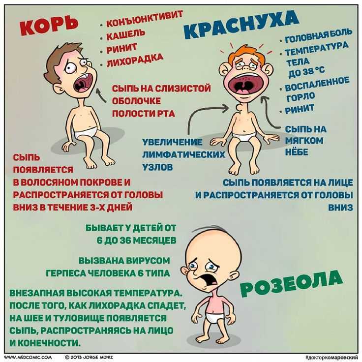 Краснуха у детей: симптомы, лечение, профилактика, видео