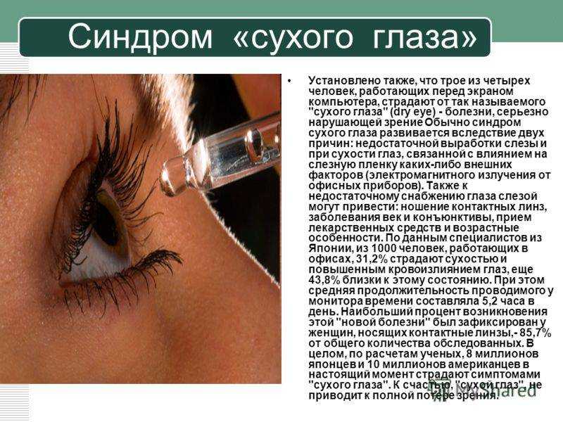Причины симптома сухого глаза. Синдром сухого глаза симптомы. Синдом сухого глаза симптомы.