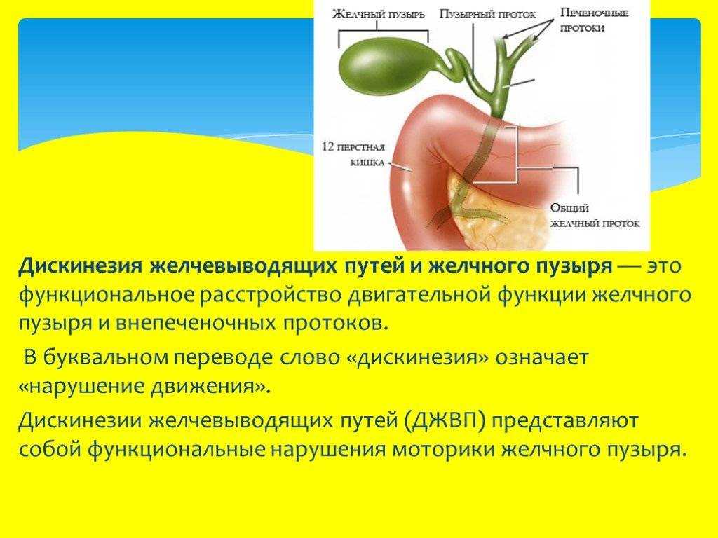 Заболевания желчного. Заболевание дискинезия желчевыводящих путей. Классификация дискинезии желчных путей. Дискинезии желчевыводящих путей и желчного пузыря классификация. Дискинезия желчного пузыря.