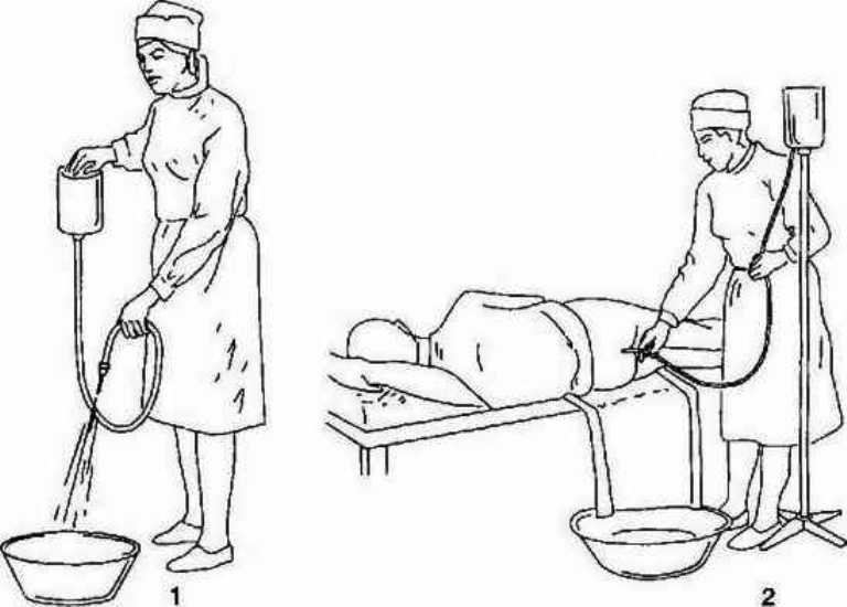 Рисунок как ставить клизму