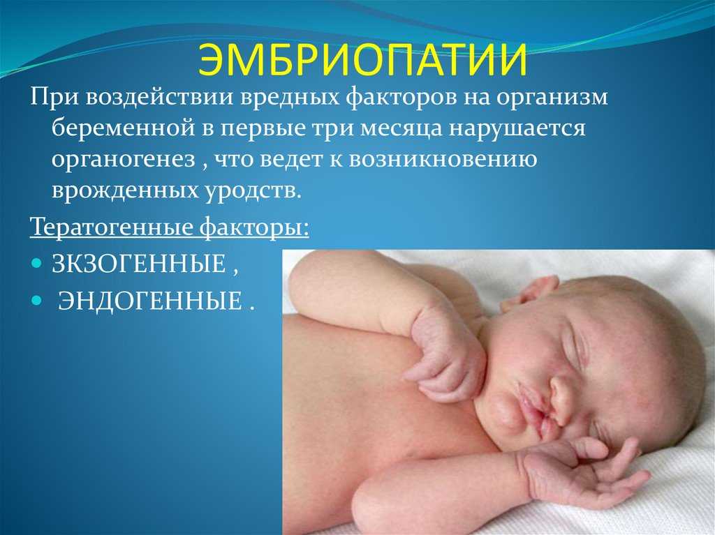 Асфиксия новорожденных - причины, оценка степеней по шкале апгар, этапы реанимации