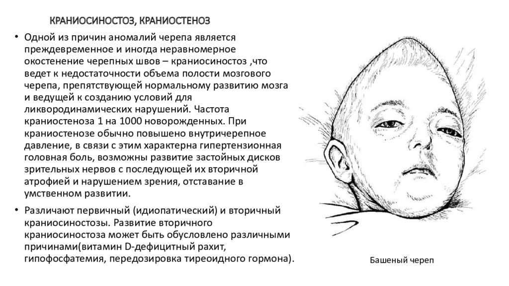 Гастрошизис плода: фото, причины, симптомы, диагностика и лечение
