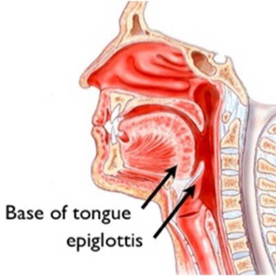 8 главных признаков эпиглоттита у ребёнка, или как распознать опасный недуг